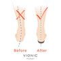ballet flats for plantar fasciitis