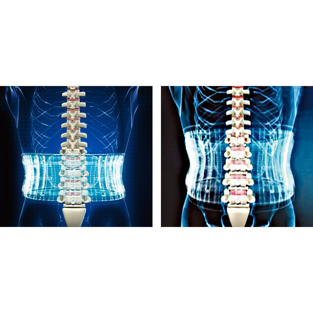 Limber Spine Decompressor Belt M Rthopaedics The Weaver Lower Back Pain  Reliever